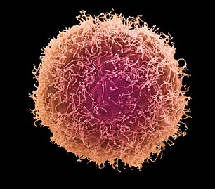 Ung thư dương vật lại nghĩ là do "quan hệ" quá nhiệt tình - 1