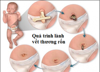 Cách chăm sóc rốn cho trẻ đúng cách
