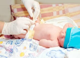 Chăm sóc rốn cho trẻ sơ sinh.