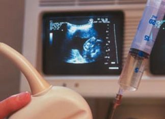 Các mẹ bầu biết gì về chọc dò nước ối chưa?