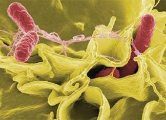 Bệnh Shigellosis