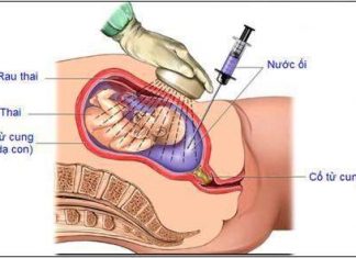 Chọc dò ối và những điều cần biết