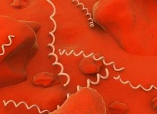 Bệnh giang mai trên người HIV