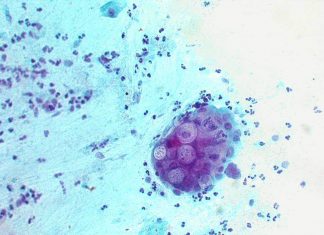 Nhiễm khuẩn chlamydia