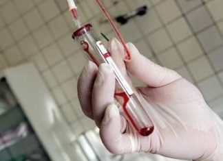 Thuốc chống phơi nhiễm HIV.