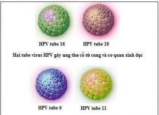 Bệnh sùi mào gà ảnh hưởng như thế nào đến trẻ sơ sinh?