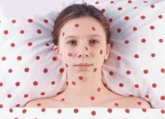 Xét nghiệm Rubella và thai kỳ