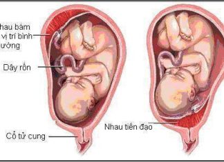 Nguyên nhân ra máu âm đạo 3 tháng giữa và cuối thai kỳ