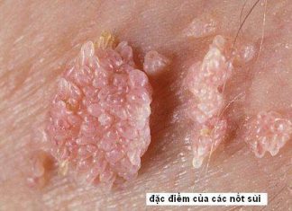 Các hình thức lây nhiễm bệnh Sùi mào gà
