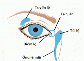 Viêm tắc tuyến lệ ở trẻ sơ sinh