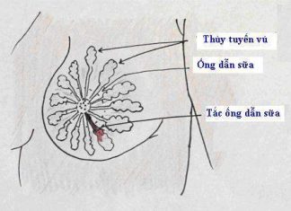 Cách xử trí và phòng tắc tia sữa sau sinh