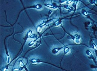 Xét nghiệm tinh dịch đồ trong khám và phát hiện vô sinh nam
