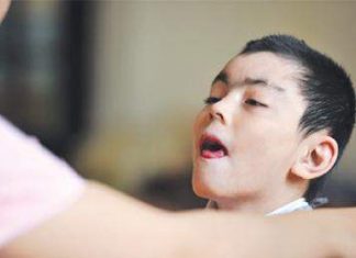 Chăm sóc trẻ tự kỷ
