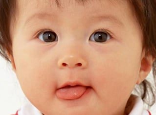 Tưa lưỡi ở trẻ sơ sinh