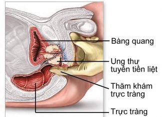Ung thư tiền liệt tuyến và các xét nghiệm chẩn đoán.
